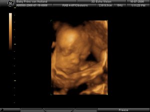 Baby duwt zich af  tegen de baarmoederwand voor goeie foto.